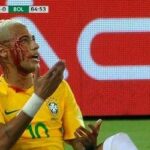 Neymar sai de campo sangrando e está suspenso para próximo jogo