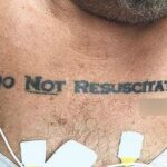 Tatuagem 'não ressuscite' em paciente deixa médicos em dúvida