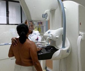 Instituto realiza exames de mamografia no bairro de São Cristovão