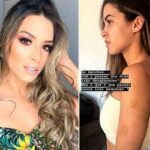 Modelo é agredida pelo namorado por causa de foto no Instagram