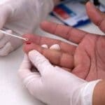 SUS distribuirá autotestes para detectar HIV a partir de 2019