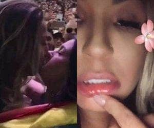 Valesca dá beijão na boca de uma garota e mostra lábio machucado