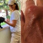 Daniela Escobar quase amputa a mão após mordida de gato