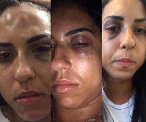 Digital influencer denuncia namorado por agressão em Salvador