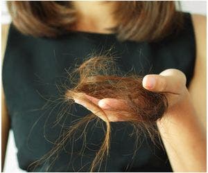Sofrendo com queda de cabelo? Entenda razão do quadro e solução