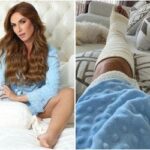 Nicole Bahls sofre acidente e quebra o pé: 'caí no chão de dor'