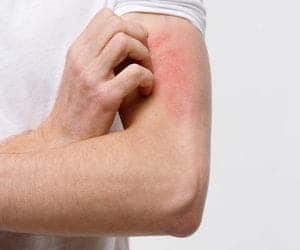 Doenças de pele: estresse e fatores emocionais podem ser a causa