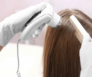 Queda de cabelo: especialistas falam sobre causas e tratamento