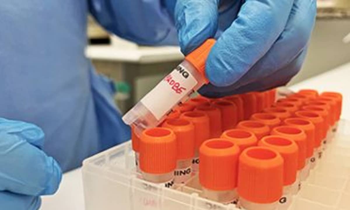 Caso suspeito da varíola do macaco na Bahia é descartado após testes laboratoriais