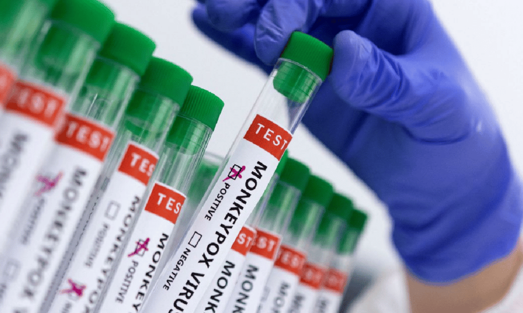 Brasil negocia compra de vacina contra varíola dos macacos