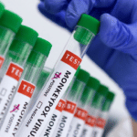 Saúde cadastra laboratórios para diagnóstico de varíola dos macacos