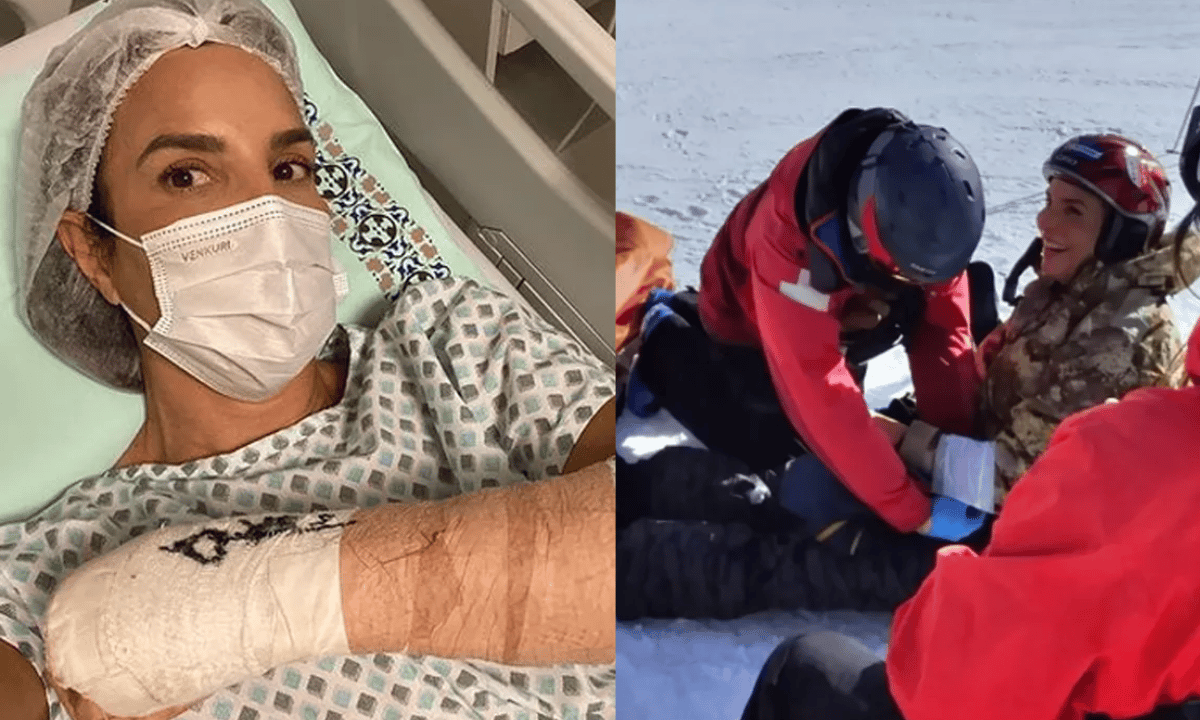 Após passar por cirurgia, Ivete Sangalo mostra vídeo de acidente esquiando: 'Dor insuportável'