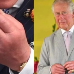 ‘Dedos de salsicha’: saiba o que pode causar e os riscos do inchaço nas mãos do rei Charles III