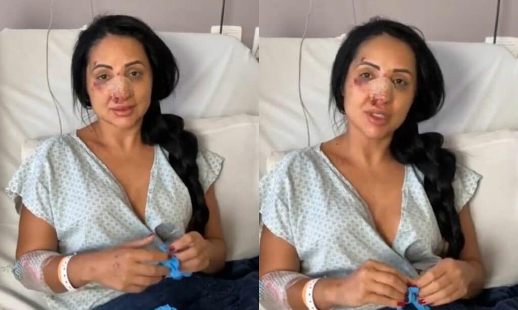 Irmã de Deolane Bezerra é internada após briga e vai passar por cirurgia: ‘Extrapolou’