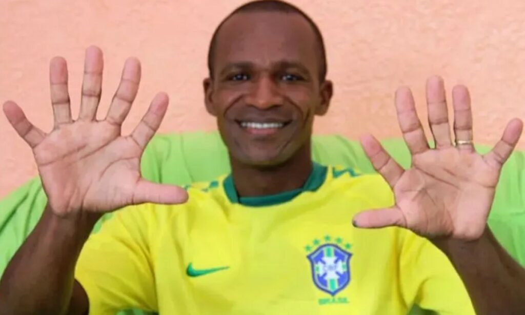 Baiano tem seis dedos em cada mão e torce para o Brasil conquistar o hexa: ‘Ansioso’